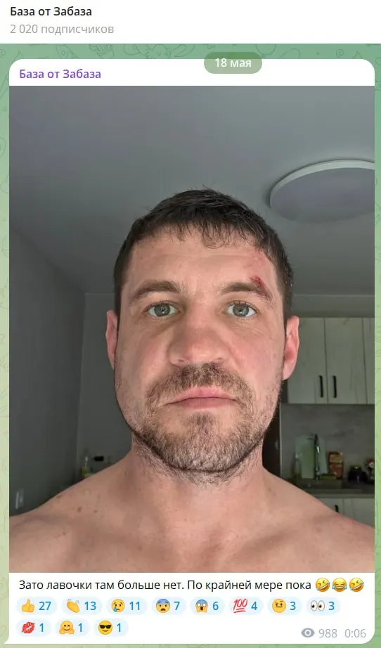 Суд заключил под стражу мужчину, обвиняемого в умышленном причинении тяжкого вреда здоровью: потерпевшему поставили диагноз тяжёлой закрытой черепно‑мозговой травмы. Подозреваемому избрана мера пресечения — два месяца в СИЗО.