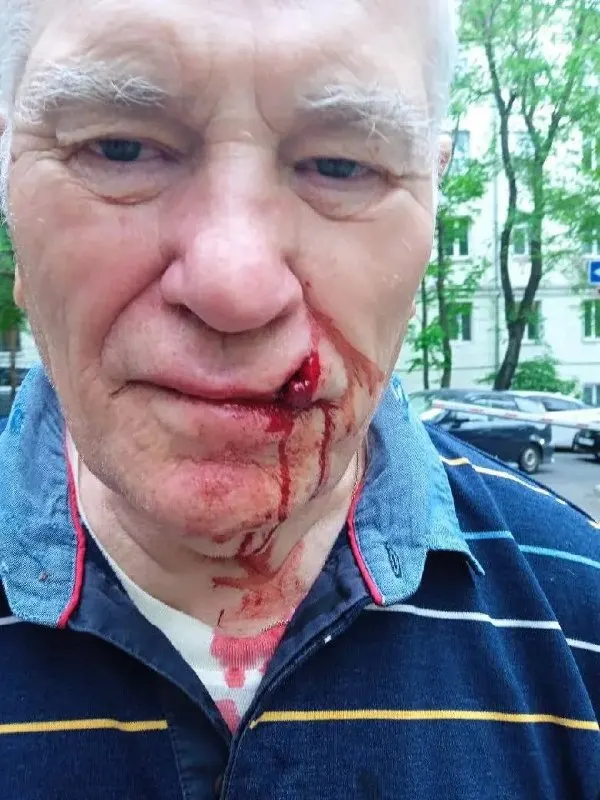 Пожилой мужчина получил травмы после конфликта с соседом у дома на улице Толстого. Родственники заявляют о бездействии участкового, который не стал запрашивать записи с камер и предложил пожилым самим собирать доказательства.